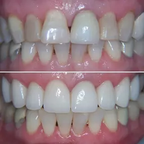 Bild von Smiles By Eddie: Dr. Edmond Ahdoot DDS