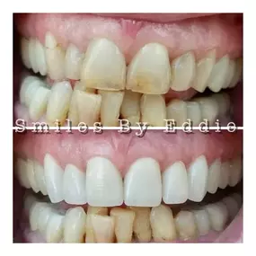 Bild von Smiles By Eddie: Dr. Edmond Ahdoot DDS