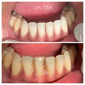 Bild von Smiles By Eddie: Dr. Edmond Ahdoot DDS