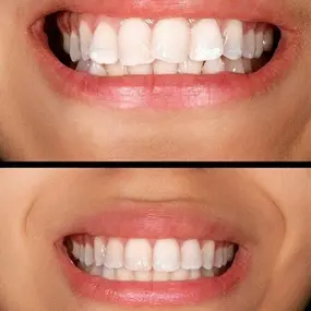 Bild von Smiles By Eddie: Dr. Edmond Ahdoot DDS