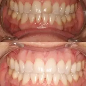 Bild von Smiles By Eddie: Dr. Edmond Ahdoot DDS