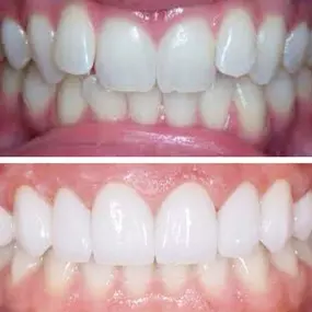 Bild von Smiles By Eddie: Dr. Edmond Ahdoot DDS