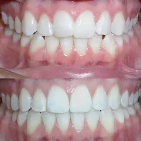 Bild von Smiles By Eddie: Dr. Edmond Ahdoot DDS