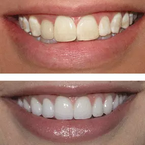 Bild von Smiles By Eddie: Dr. Edmond Ahdoot DDS