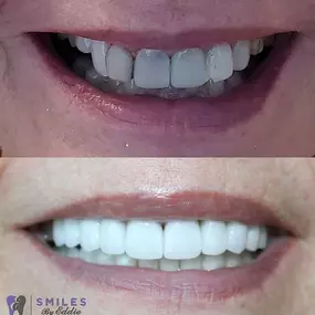 Bild von Smiles By Eddie: Dr. Edmond Ahdoot DDS