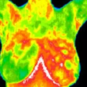 Bild von DFW Thermography, Inc