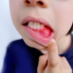 dentist Arlington Heights Abcess