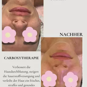 Natura Aesthetics