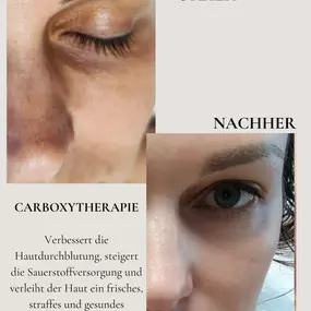 Natura Aesthetics