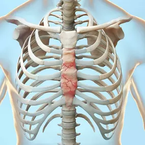 Bild von Mr Marco Scarci, Consultant Thoracic Surgeon London