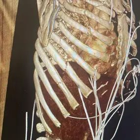 Bild von Mr Marco Scarci, Consultant Thoracic Surgeon London