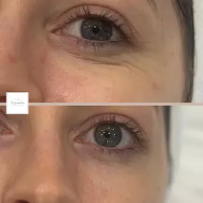 Bild von Crysallis Skin Clinic