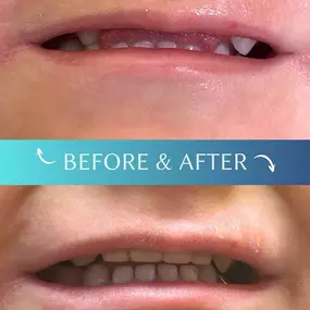 Dr. Sepehr Nassiripour in Beverly Hills