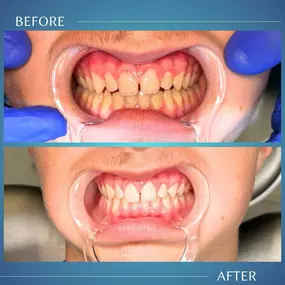 Little Smiles of Beverly Hills: Dr. Sepehr Nassiripour