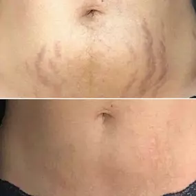 Bild von Visage New York