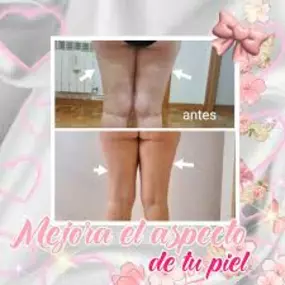 bonosmaderoterapiapinto.jpg