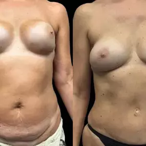 Bild von New York Group for Plastic Surgery