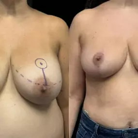 Bild von New York Group for Plastic Surgery