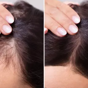 Bild von Health & Aesthetics Permanent Make Up/ Haarpigmentierung und Zahnbleaching