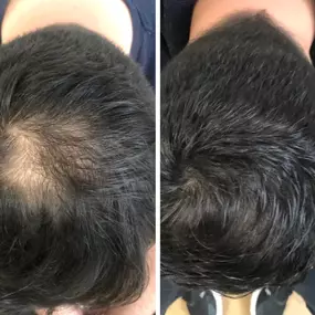 Bild von Health & Aesthetics Permanent Make Up/ Haarpigmentierung und Zahnbleaching