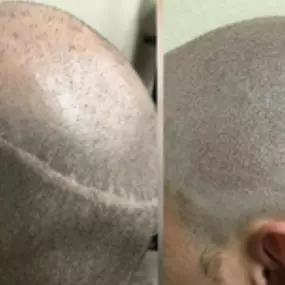 Bild von Health & Aesthetics Permanent Make Up/ Haarpigmentierung und Zahnbleaching