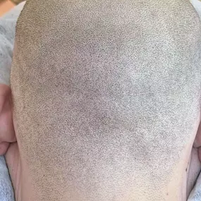 Bild von Health & Aesthetics Permanent Make Up/ Haarpigmentierung und Zahnbleaching