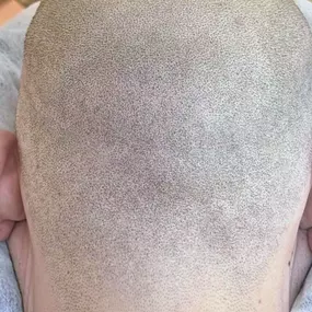 Bild von Health & Aesthetics Permanent Make Up/ Haarpigmentierung und Zahnbleaching