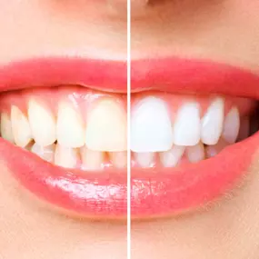 Bild von Health & Aesthetics Permanent Make Up/ Haarpigmentierung und Zahnbleaching