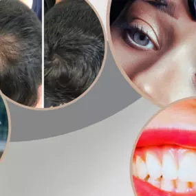 Bild von Health & Aesthetics Permanent Make Up/ Haarpigmentierung und Zahnbleaching