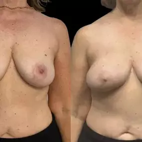 Bild von New York Group for Plastic Surgery