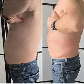 Bild von Abnehmen im liegen St Gallen