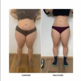 Bild von Abnehmen im liegen St Gallen