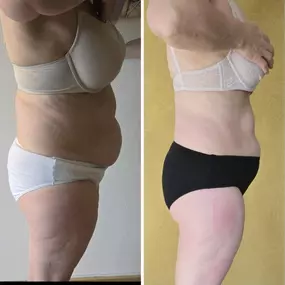 Bild von Abnehmen im liegen St Gallen