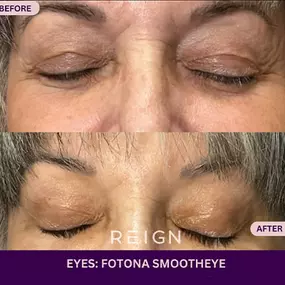 Bild von Reign Medical Aesthetics & Wellness - Windermere