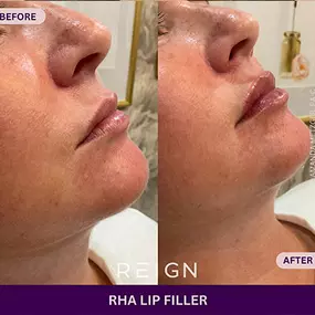 Bild von Reign Medical Aesthetics & Wellness - Windermere