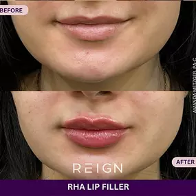 Bild von Reign Medical Aesthetics & Wellness - Windermere