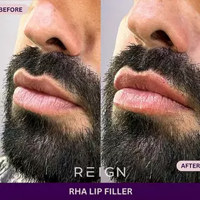 Bild von Reign Medical Aesthetics & Wellness - Windermere