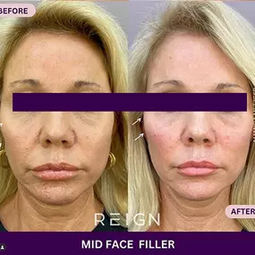 Bild von Reign Medical Aesthetics & Wellness - Windermere