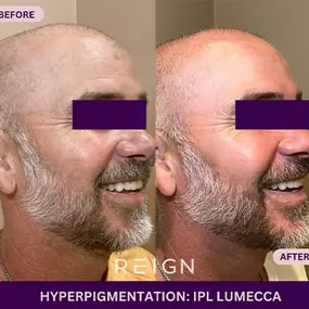 Bild von Reign Medical Aesthetics & Wellness - Windermere