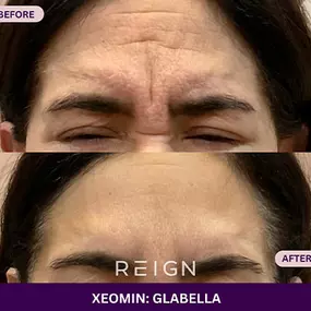 Bild von Reign Medical Aesthetics & Wellness - Windermere