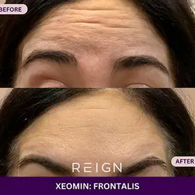 Bild von Reign Medical Aesthetics & Wellness - Windermere