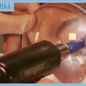 Bild von The Hill Hear Better Clinic