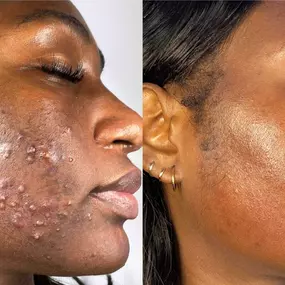 Bild von Face of Jules