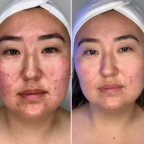 Bild von Face of Jules