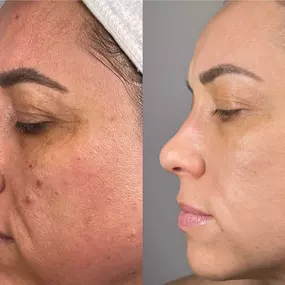 Bild von Face of Jules