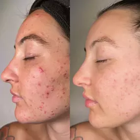 Bild von Face of Jules