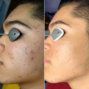 Bild von Face of Jules