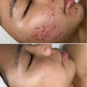 Bild von Face of Jules