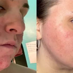 Bild von Face of Jules