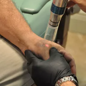 Bild von ReversaTatt Tattoo Removal